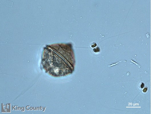 Photo of Protoperidinium sp.